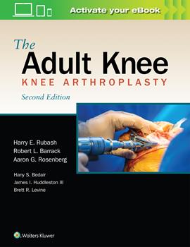 The Adult Knee-2판