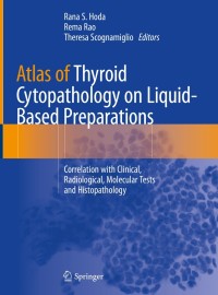 Atlas of Thyroid Cytopathology on Liquid(Hardcover)