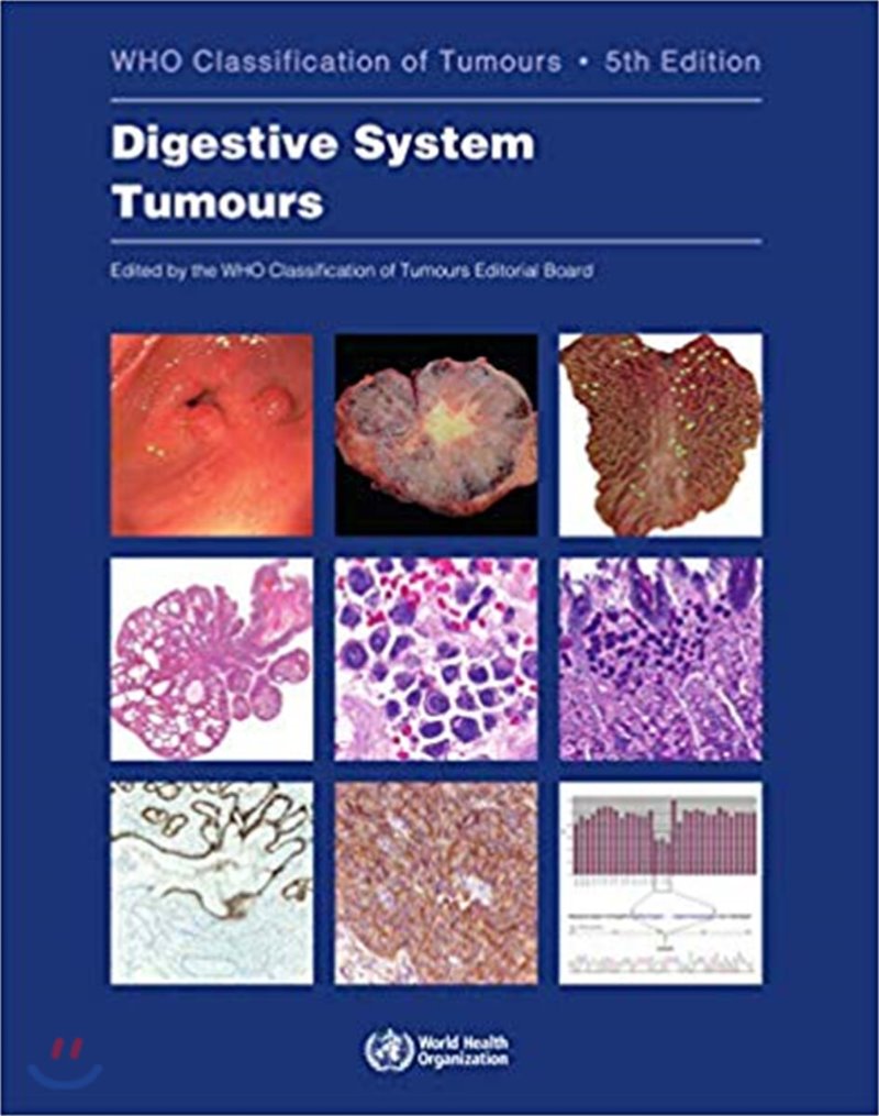 WHO Classification of Tumours of Digestive System Tumour-5판