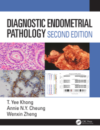 Diagnostic Endometrial Pathology-2판