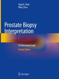 Prostate Biopsy Interpretation-2판(Hardcover)
