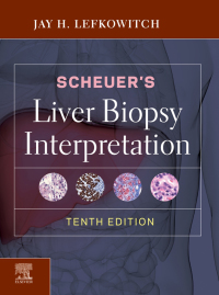 Scheuer's Liver Biopsy Interpretation-10판