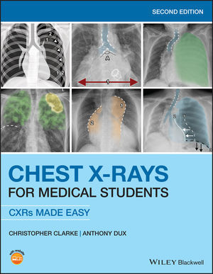 Chest X-Rays for Medical Students-2판