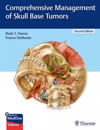 Comprehensive Management of Skull Base Tumors-2판