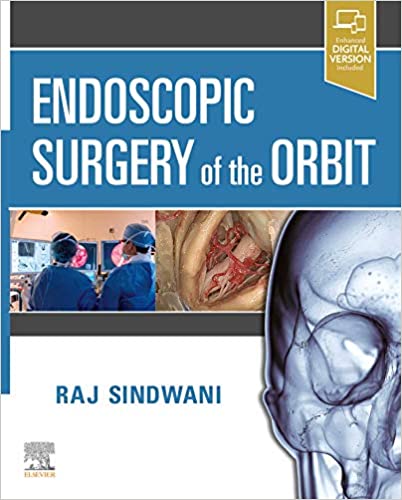 Endoscopic Surgery of the Orbit-1판