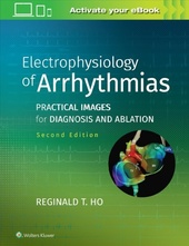 Electrophysiology of Arrhythmias-2판
