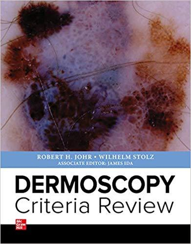 Dermoscopy Criteria Review