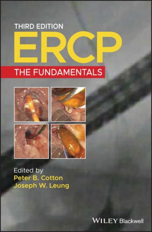 ERCP: The Fundamentals-3판
