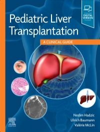 Pediatric Liver Transplantation-1판