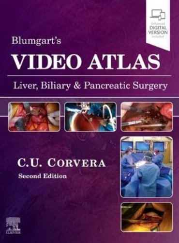 Blumgart's Video Atlas-Liver Biliary and Pancreatic Surgery-2판