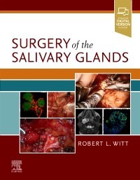 Surgery of the Salivary Glands-1판