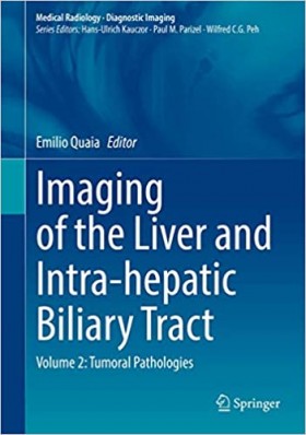 Imaging of the Liver and Intra-hepatic Biliary Tract, Volume 2: Tumoral Pathologies