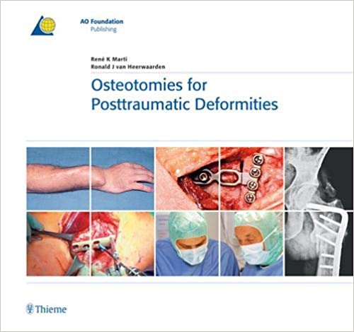 Osteotomies for Posttraumatic Deformities-1판