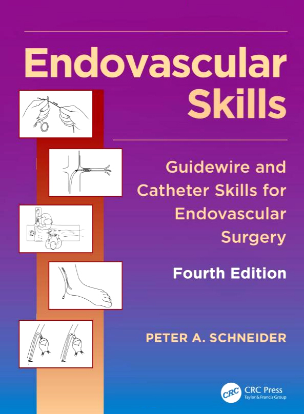 Endovascular Skills-4판
