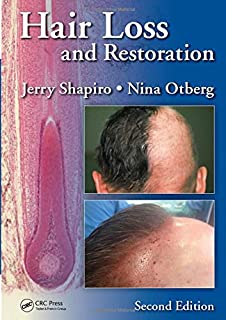 Hair Loss and Restoration-2판