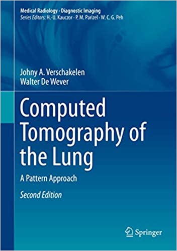 Computed Tomography of the Lung-2판