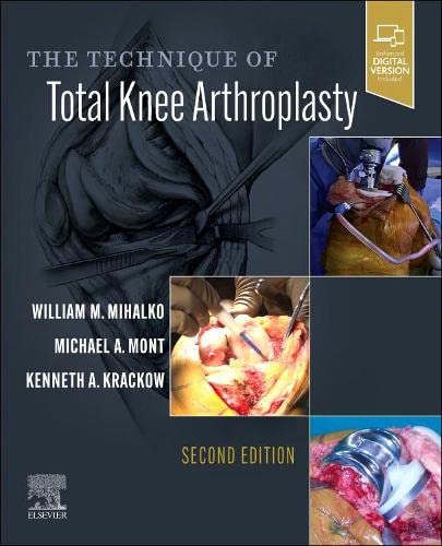 The Technique of Total Knee Arthroplasty-2판