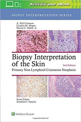 Biopsy Interpretation of the Skin-2판