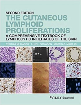 The Cutaneous Lymphoid Proliferations-2판