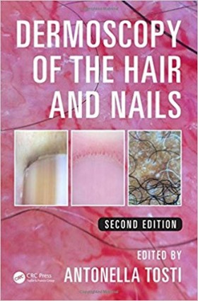 Dermoscopy of the Hair and Nails-2판
