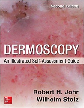 Dermoscopy: An Illustrated Self-Assessment Guide-2판