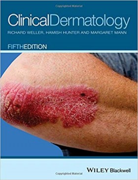 Clinical Dermatology-5판