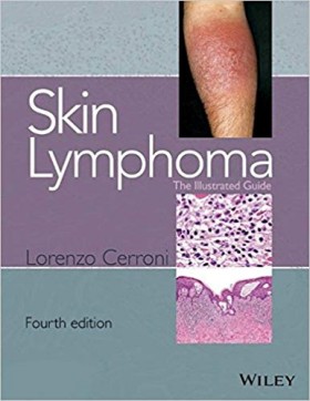 Skin Lymphoma: The Illustrated Guide-4판