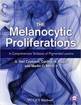 The Melanocytic Proliferations: A Comprehensive Textbook of Pigmented Lesion-2판