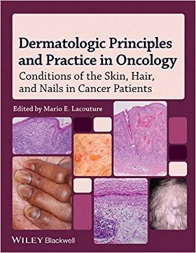 Dermatologic Principles and Practice in Oncology: Conditions of the Skin Hair and Nails in Cancer Patients