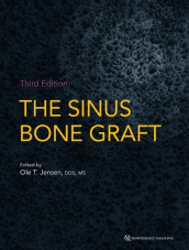 The Sinus Bone Graft-3판
