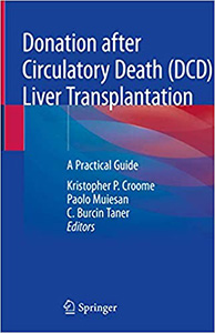 Donation after Circulatory Death (DCD) Liver Transplantation: A Practical Guide