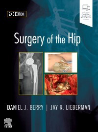 Surgery of the Hip-2판