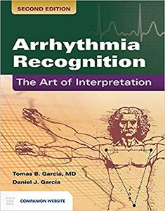 Arrhythmia Recognition: The Art of Interpretation-2판