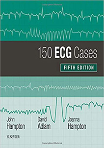 150 ECG Cases-5판