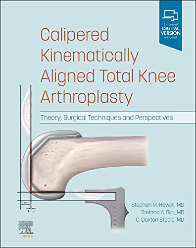 Calipered Kinematically aligned Total Knee Arthroplasty :Theory, Surgical Techniques and Perspectives – 1판