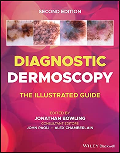Diagnostic Dermoscopy: The Illustrated Guide - 2판
