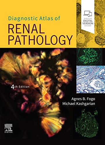 Diagnostic Atlas of Renal Pathology - 4판