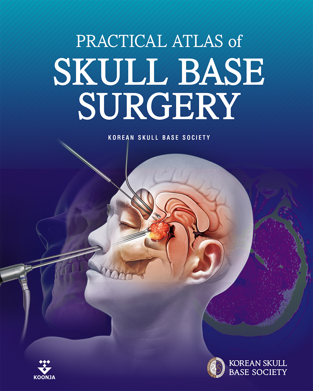 Practical atlas of skull base surgery-1