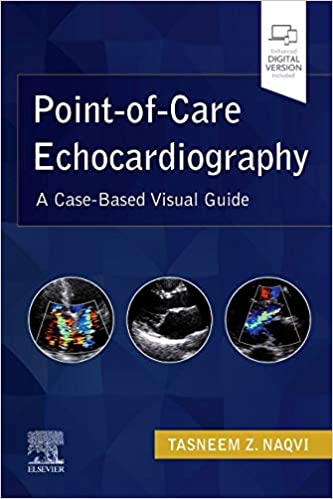 Point-of-Care Echocardiography: A Clinical Case-Based Visual Guide-1판