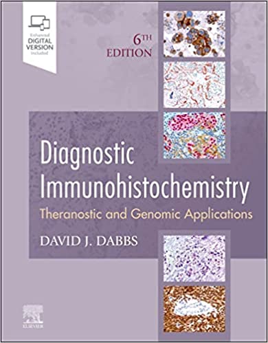 Diagnostic Immunohistochemistry: Theranostic and Genomic Applications-6판