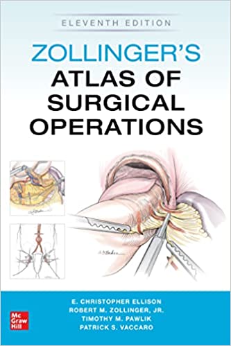 Zollinger's Atlas of Surgical Operations-11판(IE)