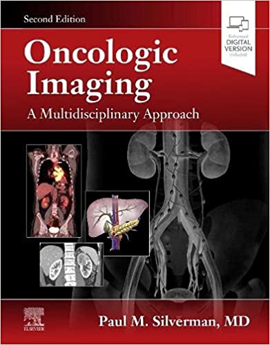 Oncologic Imaging: A Multidisciplinary Approach-2판