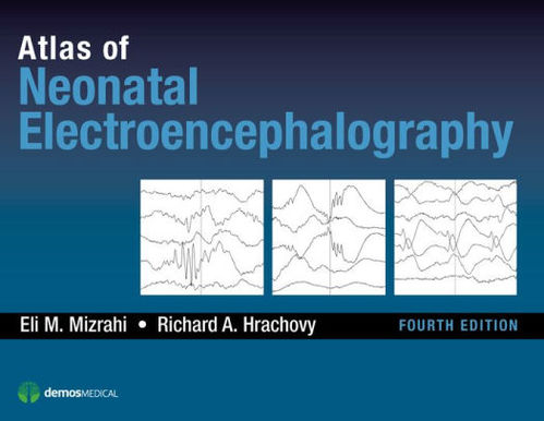 Atlas of Neonatal Electroencephalography-4판