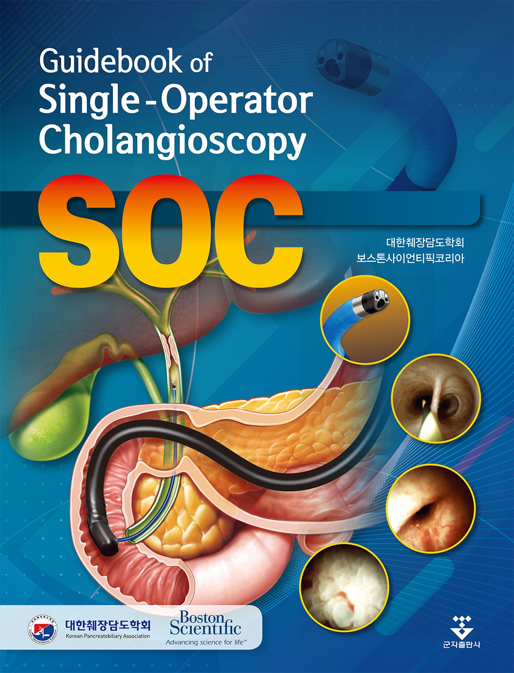 Guidebook of Single-Operator Cholangioscopy