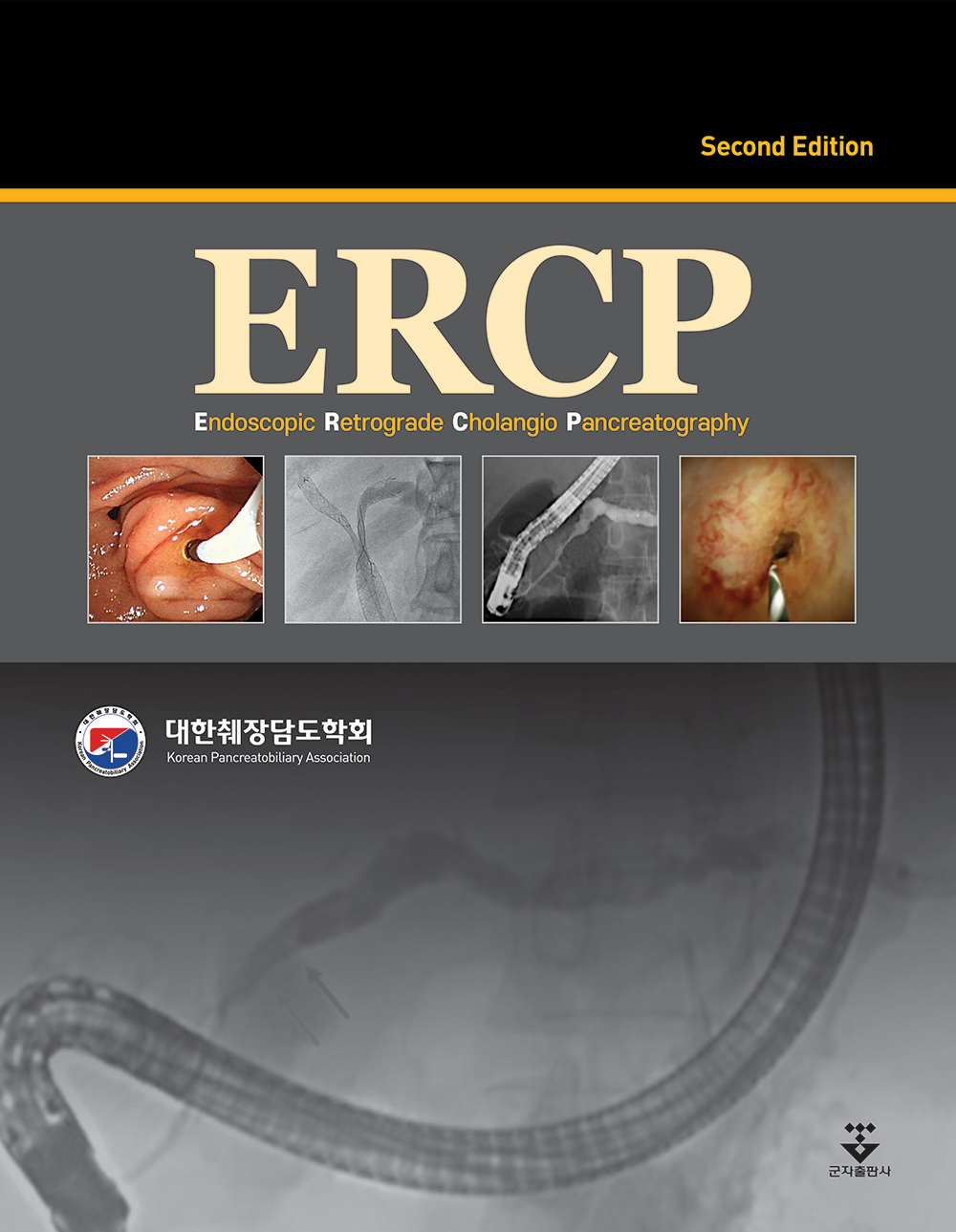 ERCP-2판