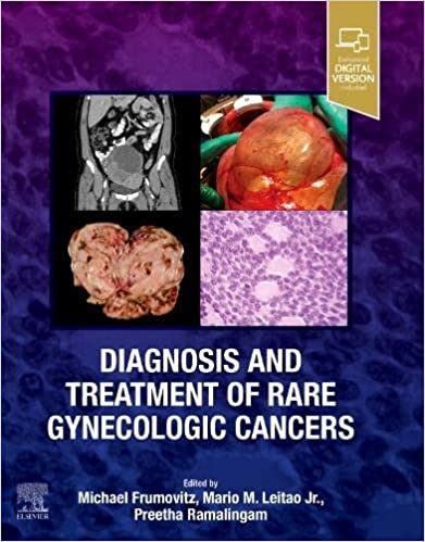 Diagnosis and Treatment of Rare Gynecologic Cancers-1판