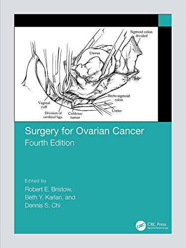 Surgery for Ovarian Cancer-4판