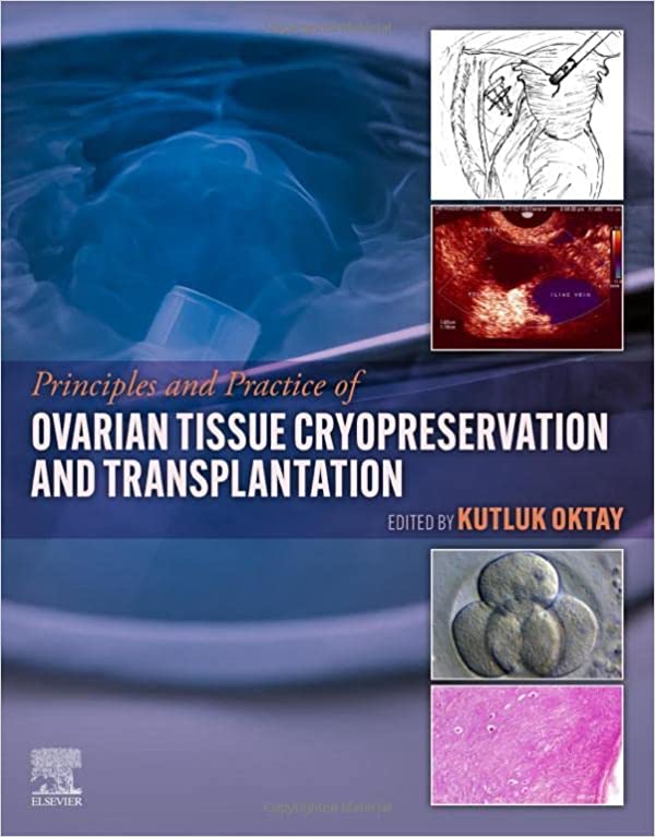 Ovarian Tissue Cryopreservation and Transplantation-1판(Paperback)