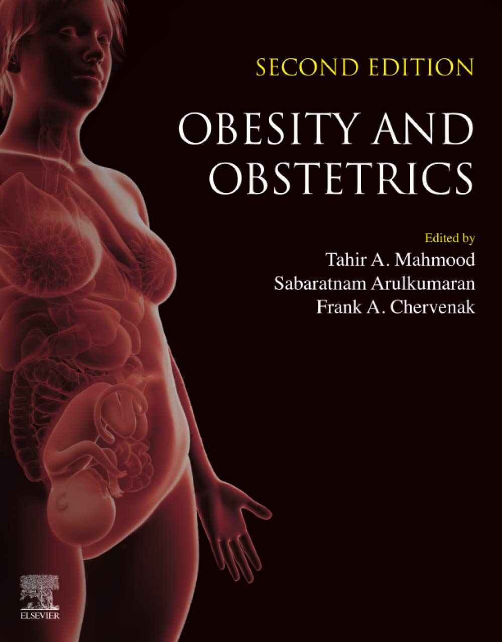Obesity and Obstetrics-2판 (Paperback)