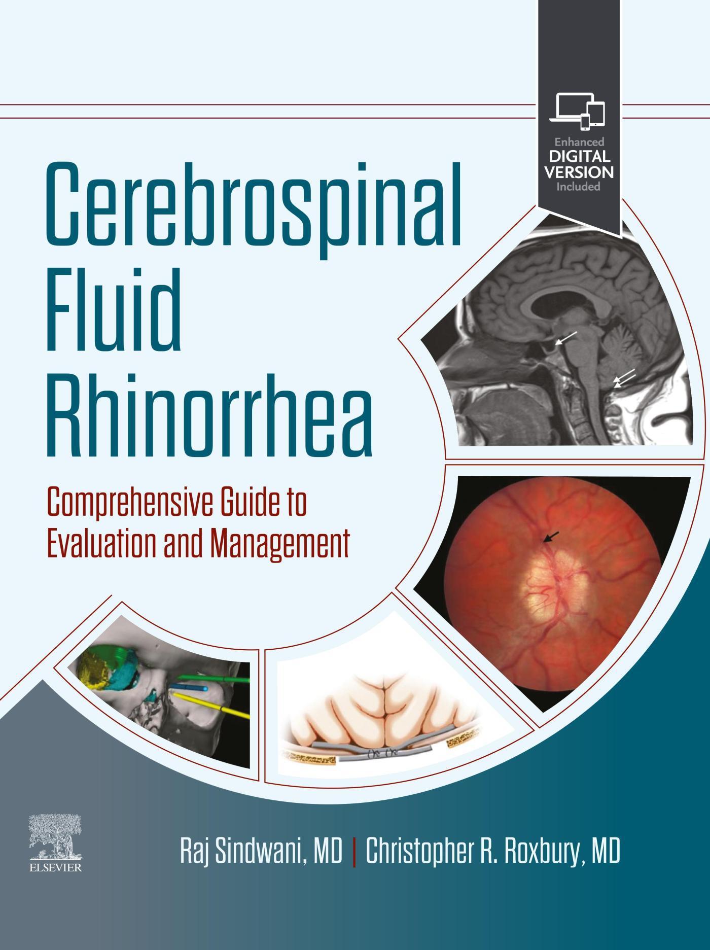 Cerebrospinal Fluid Rhinorrhea-1판